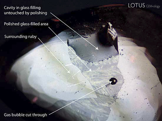 A large glass-filled surface cavity is clearly visible in this treated Thai/Cambodian ruby cabochon. The glass has a lower luster than the surrounding ruby, and in places has started to devitrify (crystallize). The upper portion of the filling is below the surface of the gem and so was not touched by the polishing wheel. The circular black dot in the center is a cavity resulting from a gas bubble cut through during the cutting process. Photo: R.W. Hughes, Lotus Gemology.