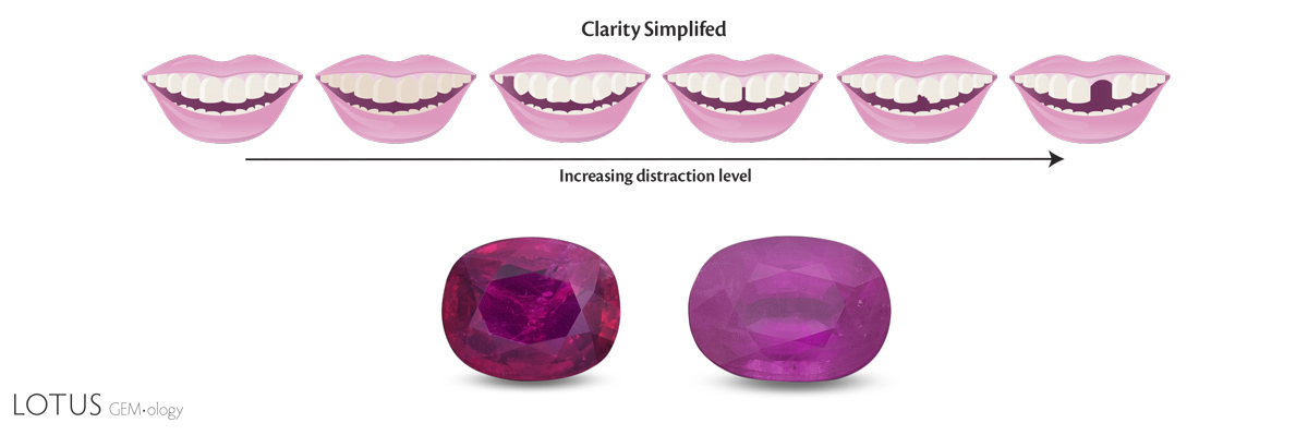 Clarity can be summarized in a single word: distraction. The degree of distraction can be seen by comparing the smiles above, where it increases as you move to the right. But real life is rarely so simple. With the two rubies above, each has different types of clarity problems. Choosing between them then becomes a personal preference.