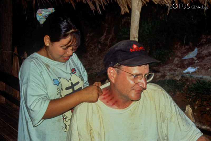 Bug spray Malaria is a major concern for anyone living or traveling in the jade-mines area. In this land of animism, the preferred local solution is embossing the skin by pinching it with a coin. The Maw-sisa miner at left is prepared for any kind of flying pest, as was Richard Hughes after he had the treatment applied. The efficacy of this bug protection was made crystal clear in Mogaung, where Hughes and Galibert slept side-by-side in the same bed. Come morning, Galibert's body was covered with bedbug bites, while Hughes was untouched.